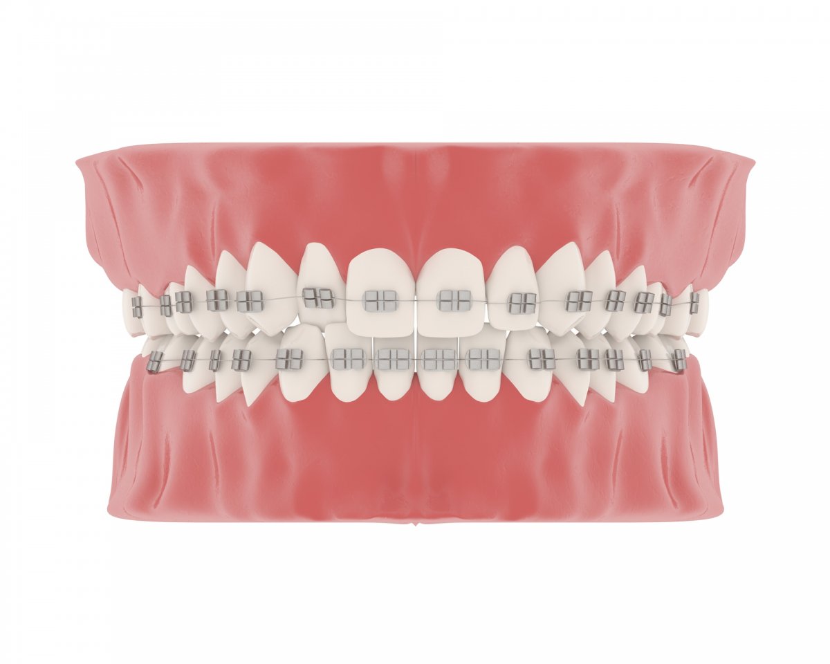 Cinema 4d Diş modelleme | Vedat ŞEKER